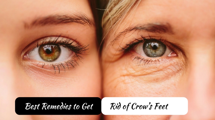 Top Four Ways to Get Rid of Crow’s Feet & Wrinkles around Eyes