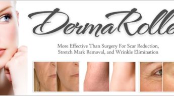How Dermaroller Treatment can help Revitalize Your Skin