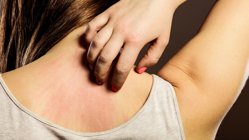 Ultimate Guide to Skin Rashes, Home Remedies & Treatment